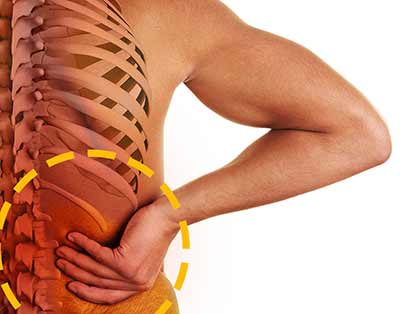 cuadrado lumbar
