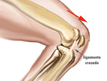 ¿Se puede doblar la rodilla en más de noventa grados?